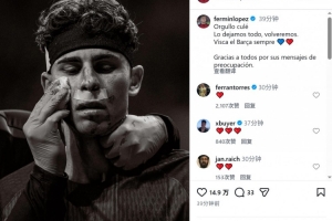 费尔明晒脸部受伤照片：我们已倾尽全力，感谢大家的关心