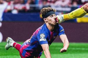 看着就疼！费尔明被穆索踢到头部，后又倒地撞向地面，当场血崩